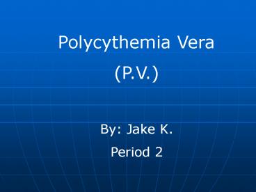 Polycythemia Vera presentation | free to view
