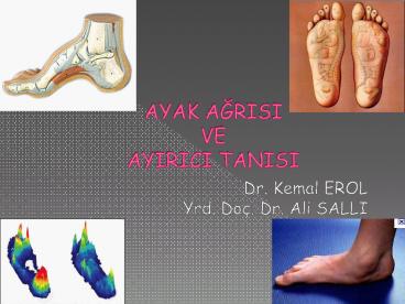 AYAK AGRISI VE AYIRICI TANISI