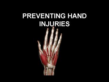 PREVENTING HAND INJURIES