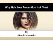 Why Hair Loss Prevention is A Must