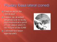 Pituitary fossa lateral (coned)