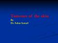 Tumours of the skin PowerPoint PPT Presentation