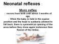 Neonatal reflexes : PowerPoint PPT Presentation