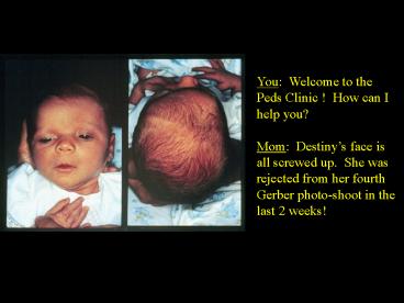 Craniosynostosis