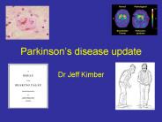 Parkinson