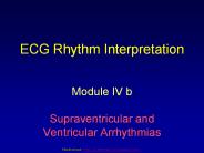 ECG Rhythm Interpretation