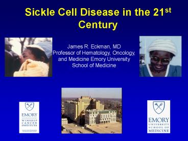 Sickle Cell Disease in the 21st Century