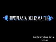 HIPOPLASIA DEL ESMALTE