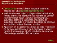 Afecciones del Reci
