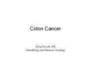 Colon Cancer Overview