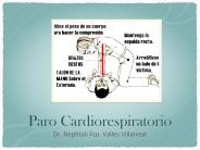 Paro Cardiorespiratorio