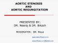 AORTIC STENOSIS             AND    AORTIC REGURGITATION PowerPoint PPT Presentation