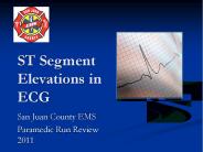 ST Segment Elevations in ECG