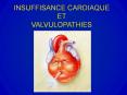 INSUFFISANCE CARDIAQUE ET VALVULOPATHIES PowerPoint PPT Presentation