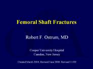 Femoral Shaft Fractures