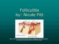 Folliculitis by: Nicole Pitt PowerPoint PPT Presentation