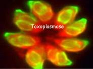 Toxoplasmose