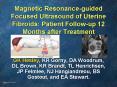 Magnetic Resonance-guided Focused Ultrasound of Uterine Fibroids: Patient Follow-up 12 Months after Treatment PowerPoint PPT Presentation