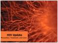 HIV Update PowerPoint PPT Presentation
