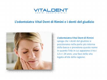 L'estrazione dei denti del giudizio secondo l’Odontoiatra Vital Dent di Rimini