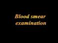 Blood smear examination PowerPoint PPT Presentation