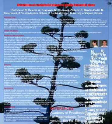 Orientation of craniofacial planes to gravity horizontal plane