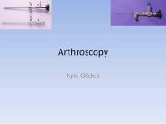 Arthroscopy