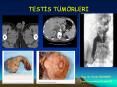 TESTIS T PowerPoint PPT Presentation