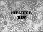 HEPATITE B (HBV)