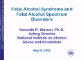 Fetal Alcohol Syndrome and Fetal Alcohol Spectrum Disorders PowerPoint PPT Presentation