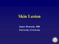 Skin Lesion PowerPoint PPT Presentation