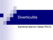 Diverticulitis