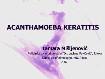 ACANTHAMOEBA KERATITIS