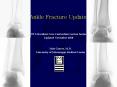 Ankle Fracture Update PowerPoint PPT Presentation