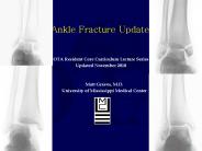 Ankle Fracture Update