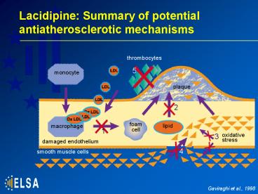 Lacidipine: Summary of potential antiatherosclerotic mechanisms