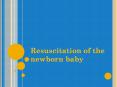 Resuscitation of the newborn baby PowerPoint PPT Presentation