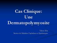 Cas Clinique: Une Dermatopolymyosite