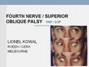 FOURTH NERVE / SUPERIOR OBLIQUE PALSY  FNP / SOP