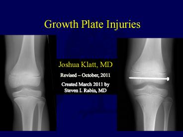 Growth Plate Injuries