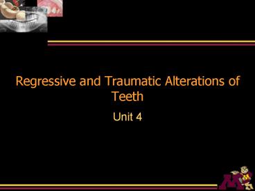 Regressive and Traumatic Alterations of Teeth