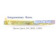 Integumentary: Burns PowerPoint PPT Presentation
