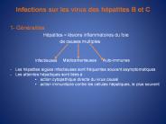 Infections sur les virus des h