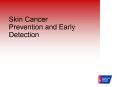 Skin Cancer Prevention and Early Detection PowerPoint PPT Presentation