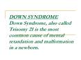 DOWN SYNDROME Down Syndrome, also called Trisomy 21 is the most common cause of mental retardation and malformation in a newborn. PowerPoint PPT Presentation