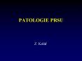PATOLOGIE PRSU PowerPoint PPT Presentation