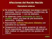 Afecciones del Reci