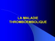 LA MALADIE THROMBOEMBOLIQUE