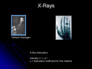 X-Rays