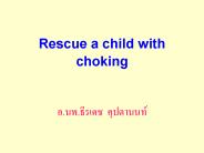 Rescue a child with choking